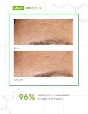 Crema facial recomendada para prevenir signos de la edad de noche Murad Resurgence para todo tipo piel