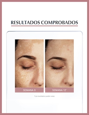 Crema facial recomendada para reducir manchas día y noche Eucerin Anti-Pigment para todo tipo piel