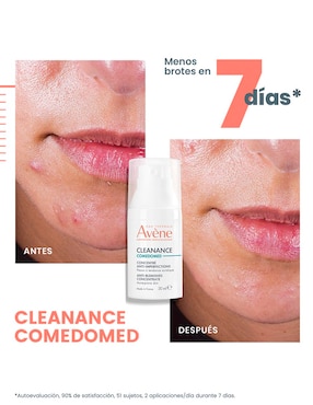 Crema facial recomendada para acné día y noche Avène Comedomed para piel grasa
