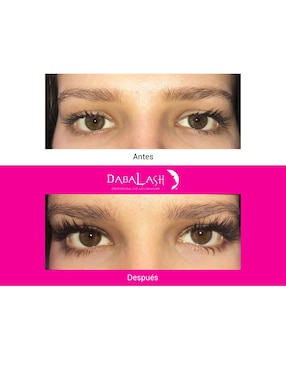 Tratamiento para ojos Dabalash