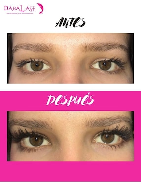 Tratamiento para ojos Combo Love Suero Dabalash