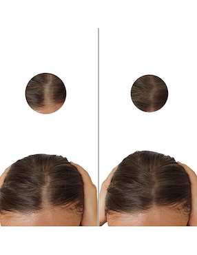 Tratamiento para barba y cabello crecimiento Minoxytop