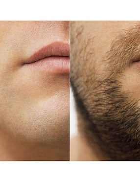 Tratamiento para barba y cabello crecimiento Minoxytop