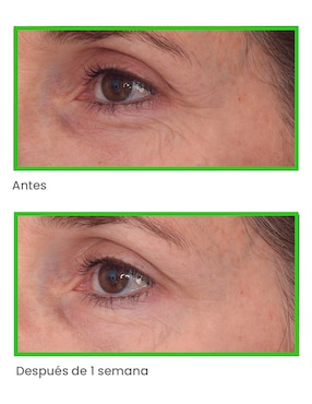 Crema para contorno de ojos recomendada para bolsas y ojeras de día y noche Murad para todo tipo piel