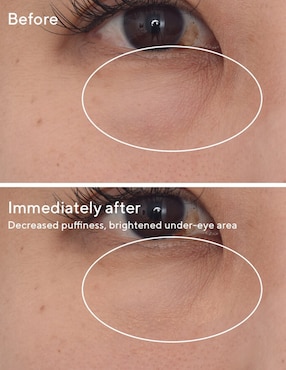 Tratamiento para ojos antiojeras Murad Blemish