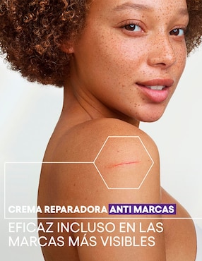 Crema para rostro y cuerpo recomendada para reparar de día y noche Aderma Epitheliale Reparadora Anti-Marcas para piel sensible