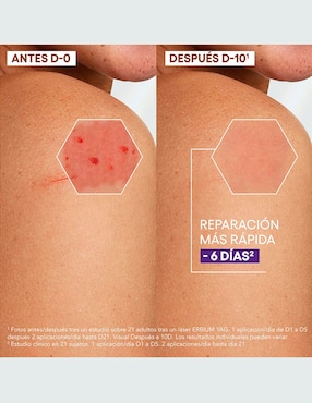 Crema para rostro y cuerpo recomendada para reparar de día y noche Aderma Epitheliale Reparadora Anti-Marcas para piel sensible