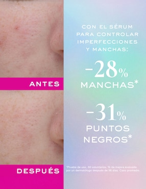 Sérum hidratante facial Anti-Imperfecciones y Anti-Granos Nuxe Zinc Power todo tipo piel
