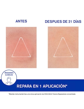 Crema facial recomendada para reparar día y noche Uriage Cica Daily para todo tipo piel