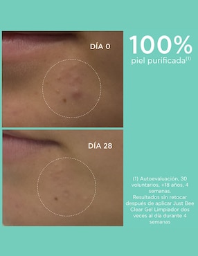 Limpiador facial Just Bee Clear Apivita Acne Line para acné