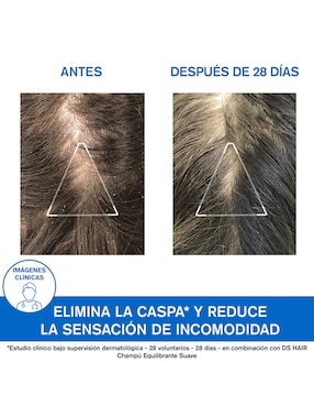 Shampoo anticaspa para cabello normal DS Hair Uriage D.S. 200 ml