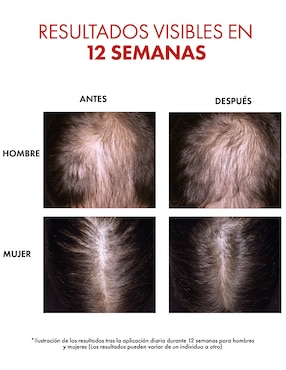 Sérum capilar Dercos regen Vichy