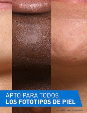 Parches para acné control imperfecciones Cerave
