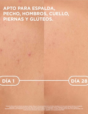 Tratamiento corporal Kerato+ Spray Antiacné Bioderma Sébium