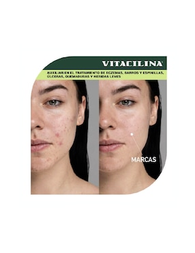 Ungüento Vitacilina