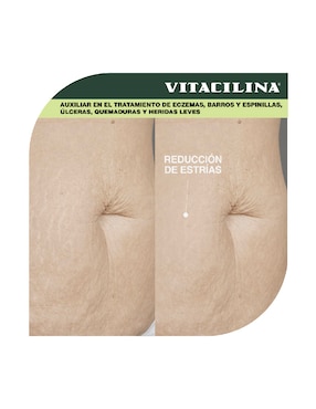 Ungüento Vitacilina