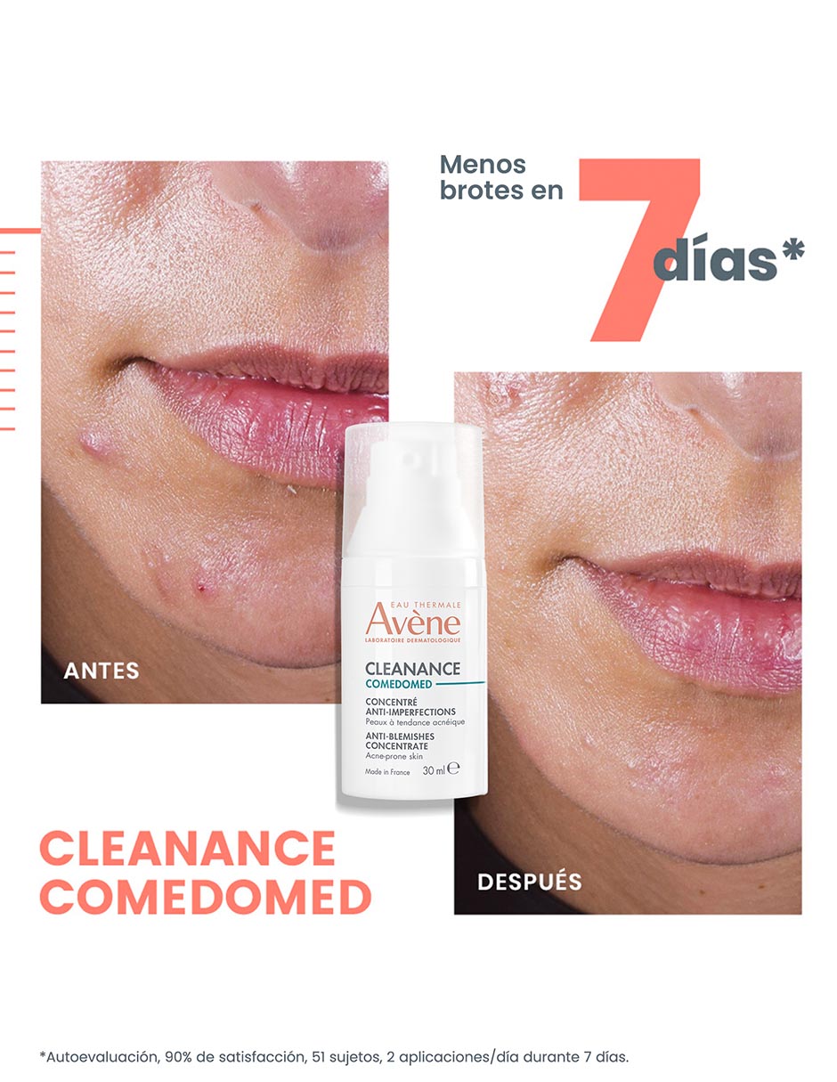 Crema facial recomendada para acné día y noche Comedomed para piel grasa 4
