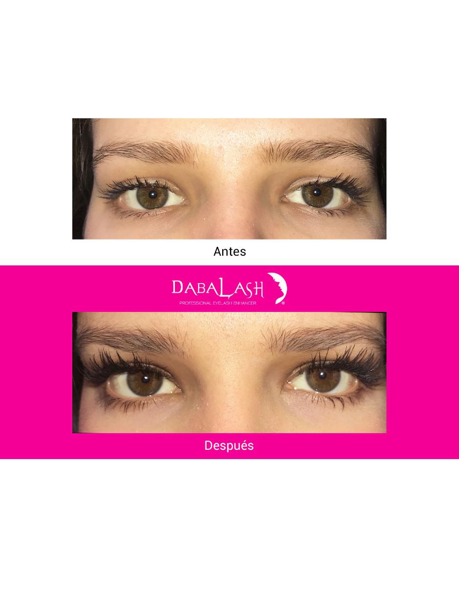 Tratamiento para ojos 3