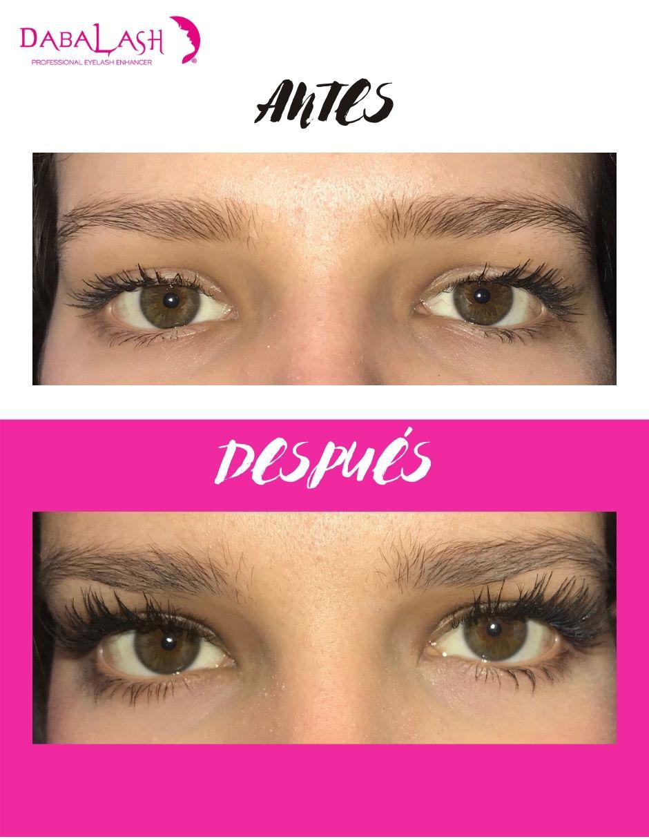 Tratamiento para ojos Combo Love Suero 4