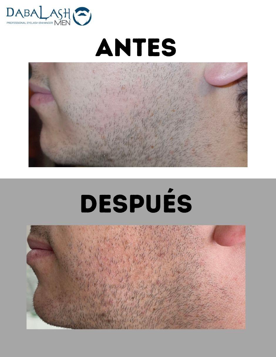 Tratamiento para ojos Combo Love Suero 5