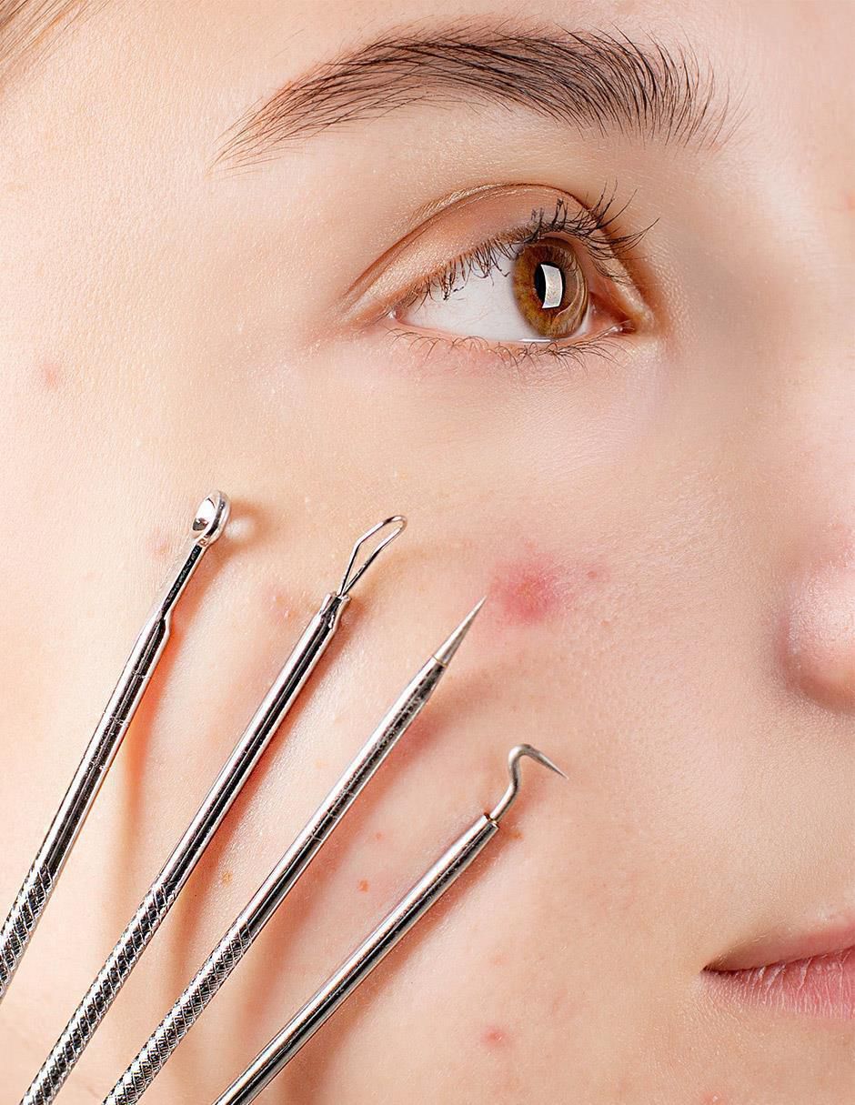 Limpiadores de rostro y cuerpo Spini 4 recomendado para eliminar puntos negros 6
