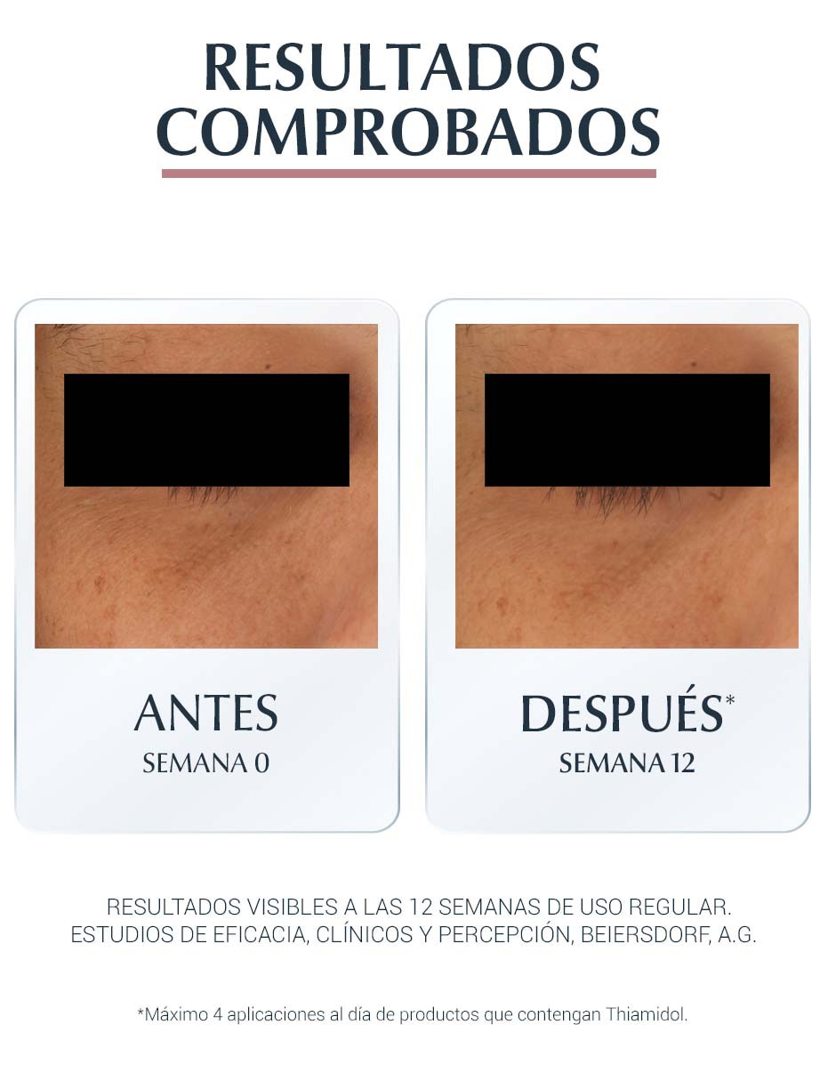 Crema para contorno de ojos recomendada para bolsas y ojeras día y noche Anti-Pigment Anti-Ojeras Eucerin Anti Pigment todo tipo piel 7