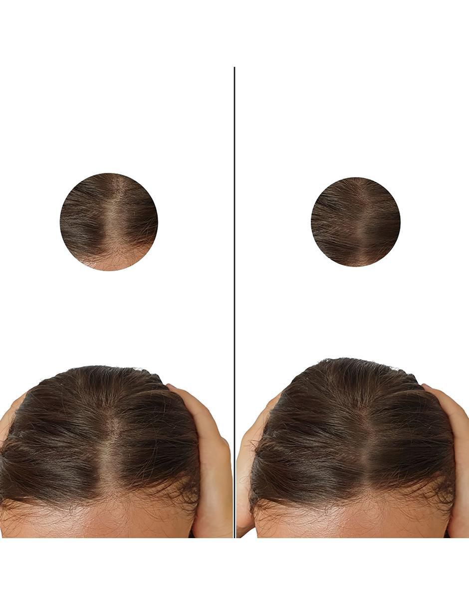Tratamiento para barba y cabello crecimiento 5