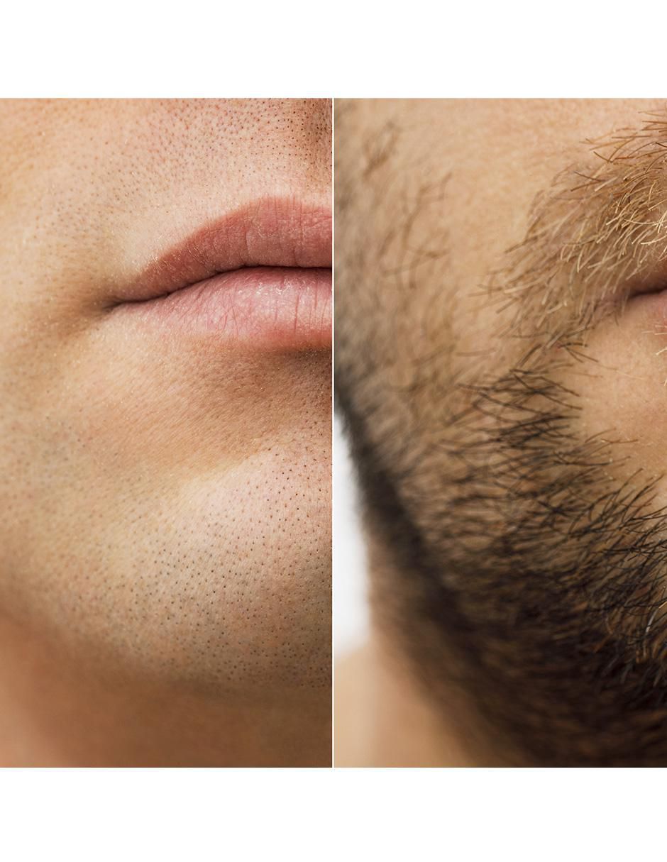 Tratamiento para barba y cabello crecimiento 6
