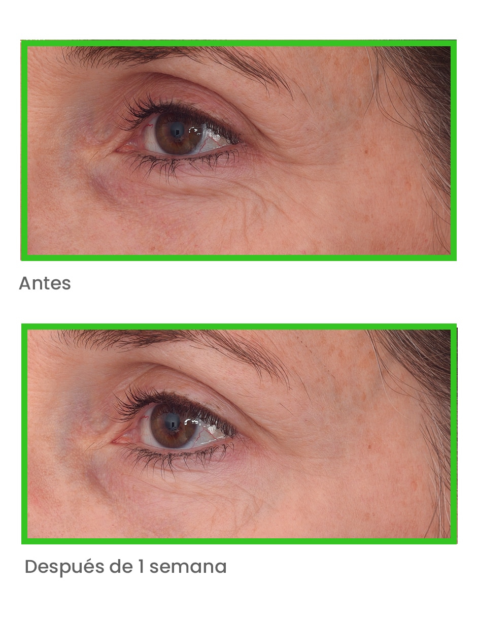 Crema para contorno de ojos recomendada para bolsas y ojeras día y noche - Retinal Resculpt Eye Treatment - Tratamiento Intensivo Antiedad Para Ojos 15Ml Murad todo tipo piel 3
