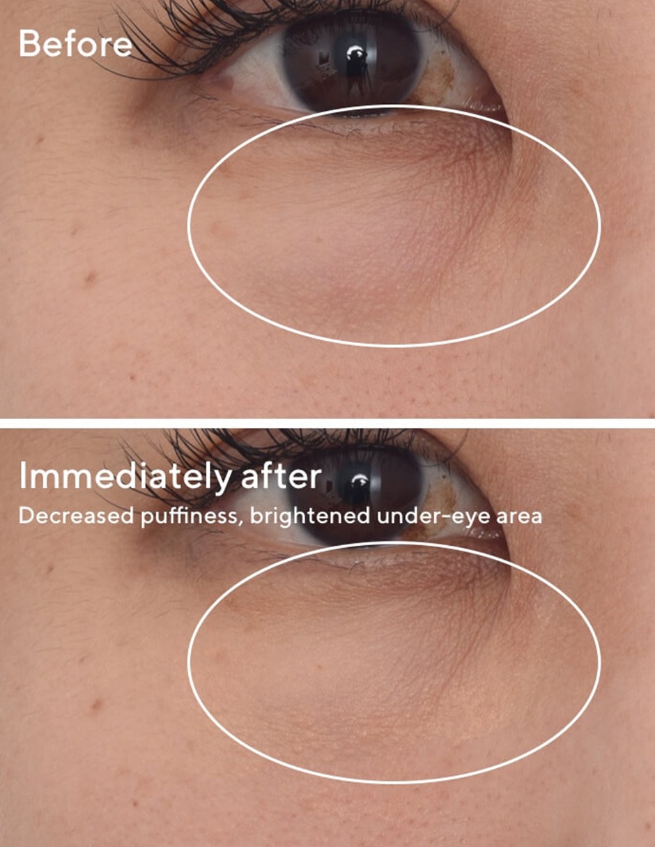 Tratamiento para ojos antiojeras Blemish 3