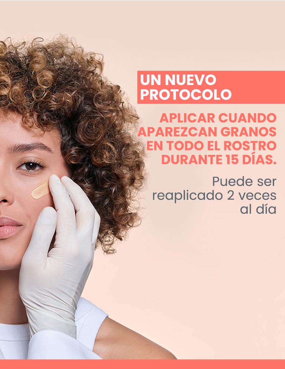 Crema facial recomendada para acné noche para piel grasa 4