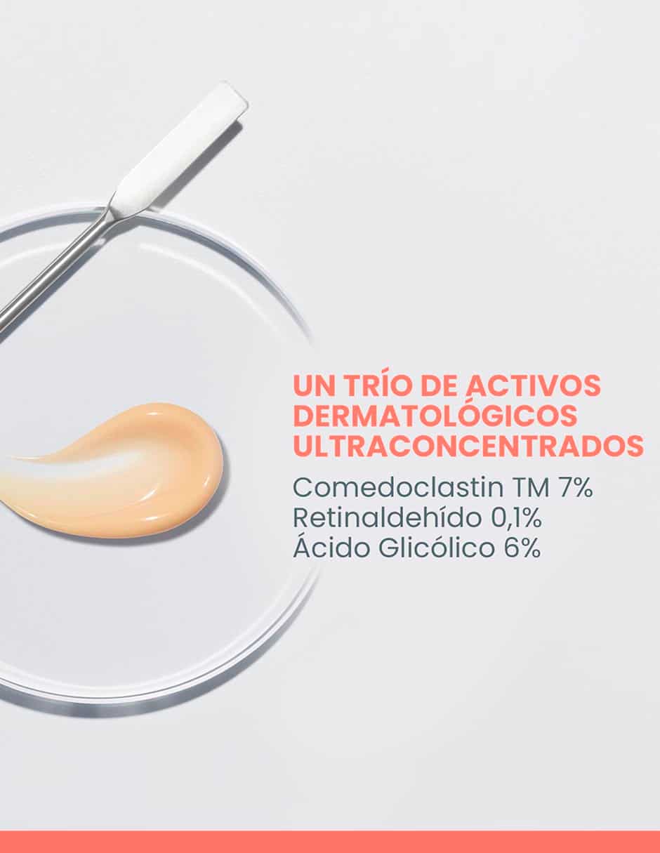 Crema facial recomendada para acné noche para piel grasa 5