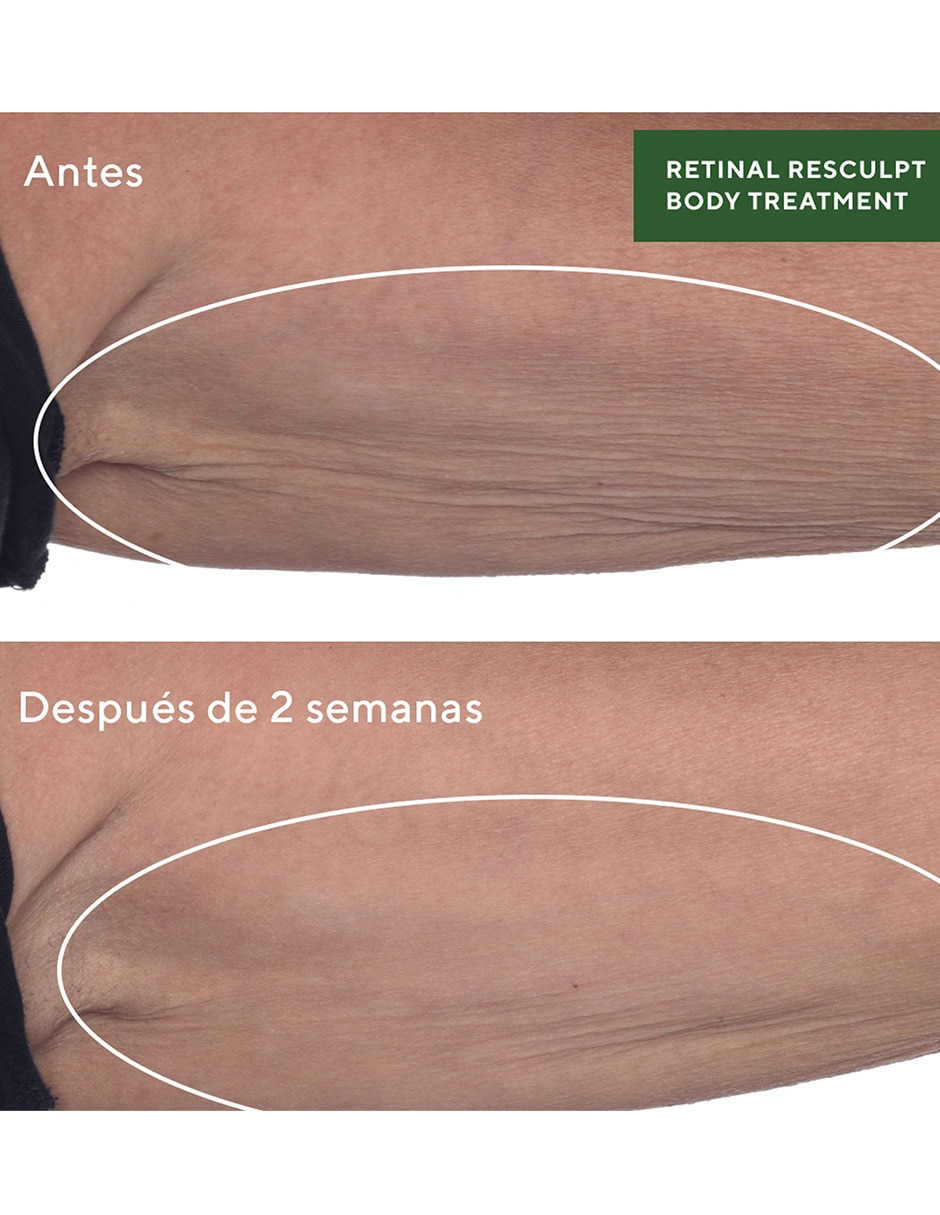 Tratamiento corporal reafirmante antiedad Resurgence 5