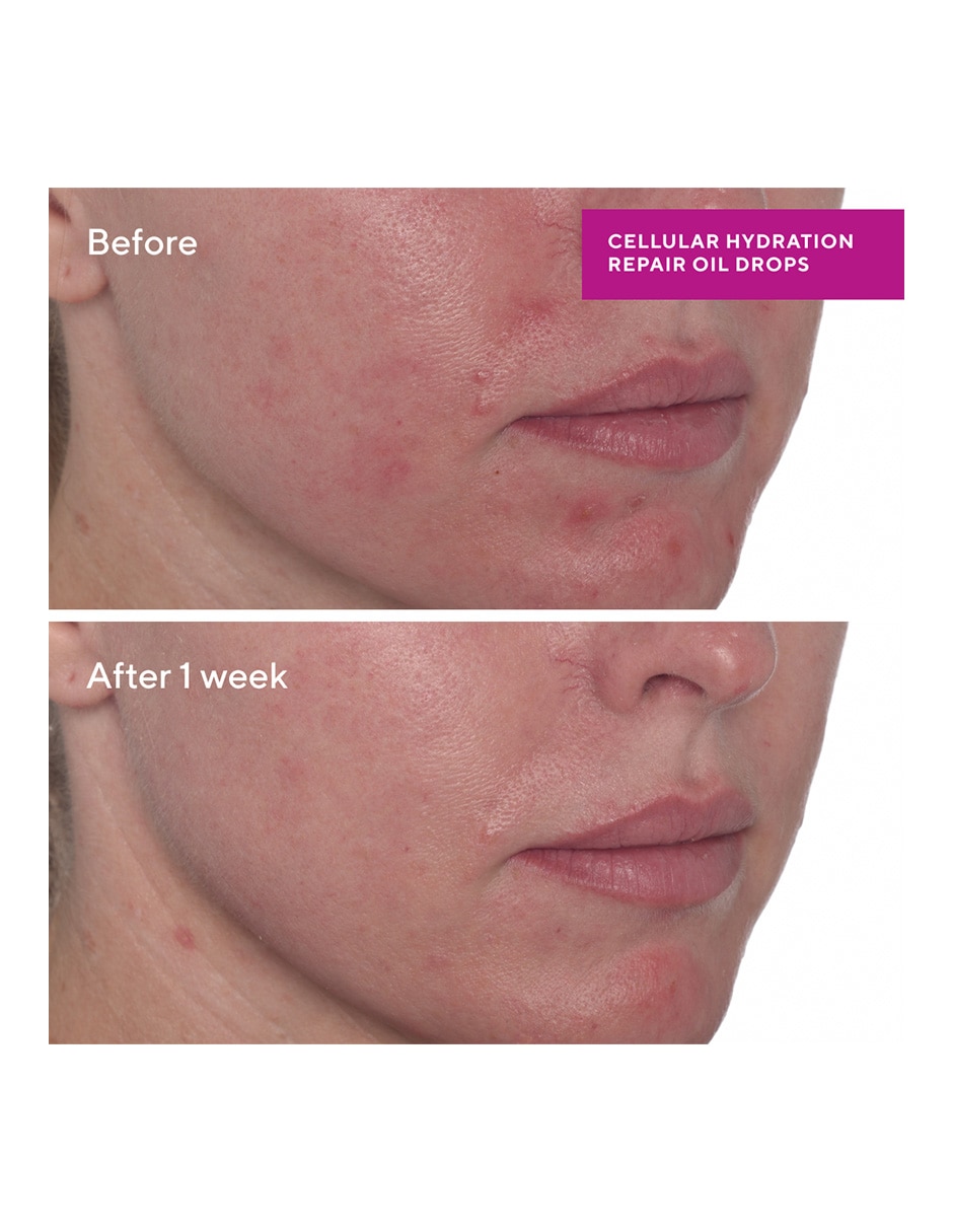 Tratamiento facial Cellular Hydration Repair Oil Drops 5