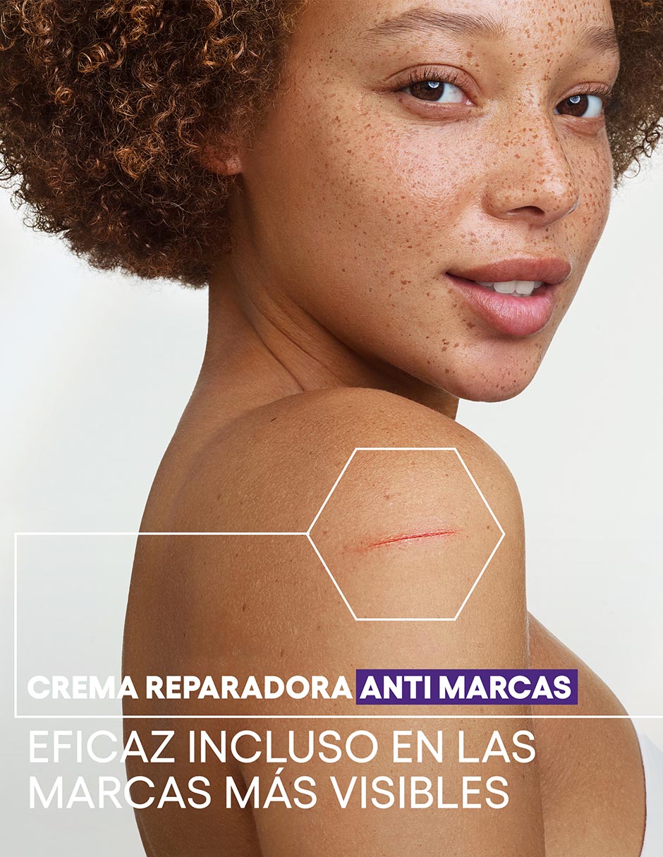 Crema para rostro y cuerpo recomendada para reparar de día y noche Epitheliale Reparadora Anti-Marcas para piel sensible 2