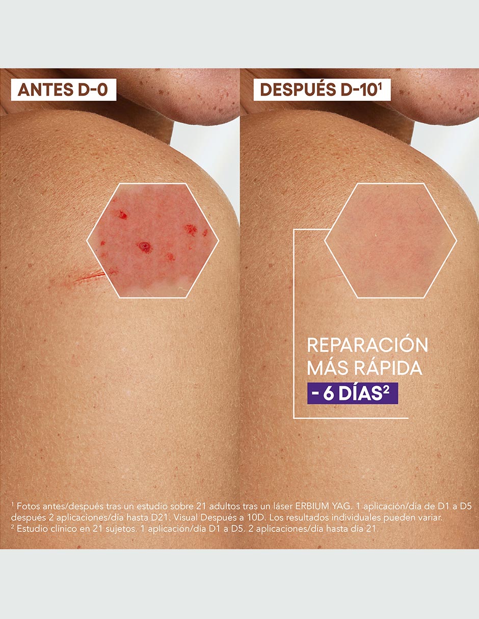Crema para rostro y cuerpo recomendada para reparar de día y noche Epitheliale Reparadora Anti-Marcas para piel sensible 3