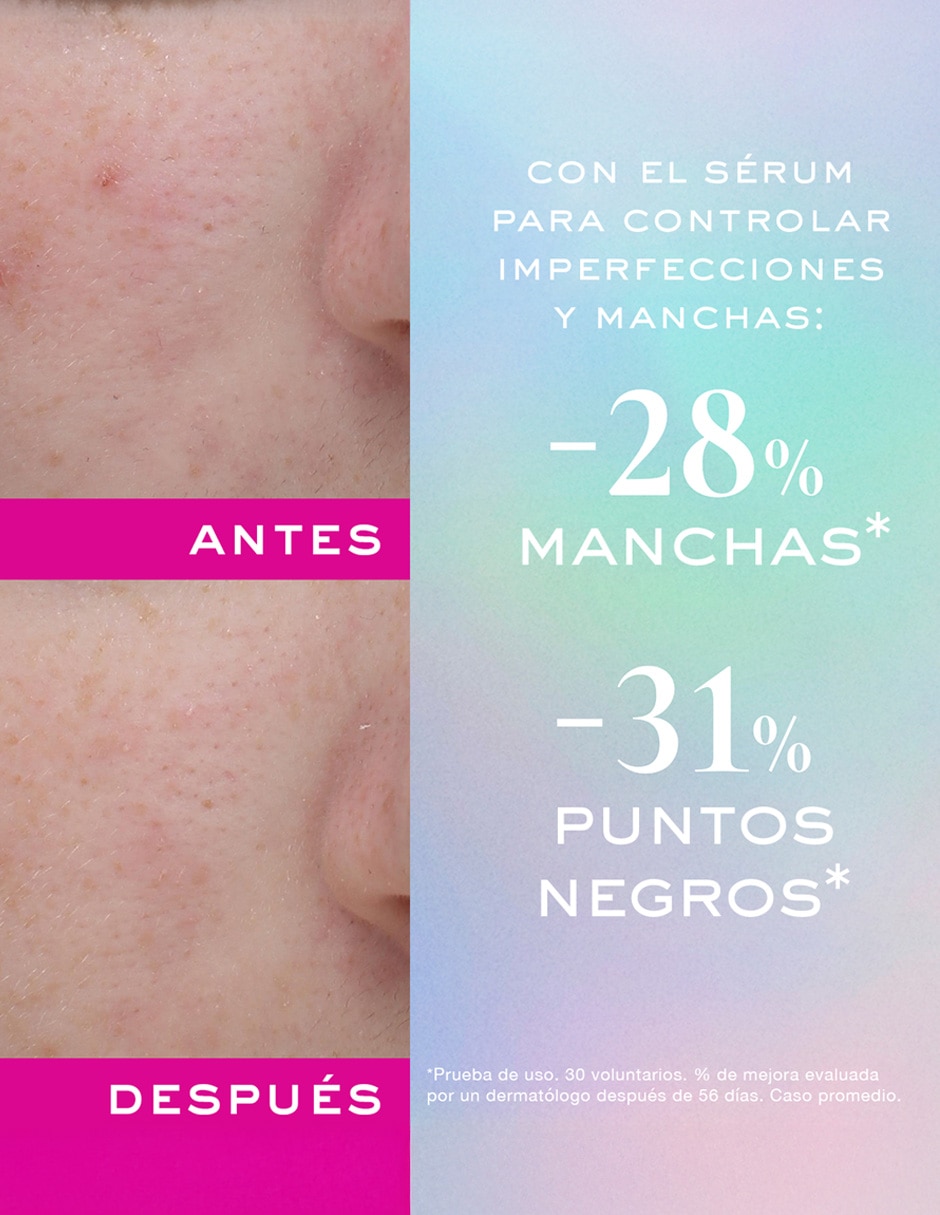 Sérum hidratante facial Anti-Imperfecciones y Anti-Granos Zinc Power todo tipo piel 3
