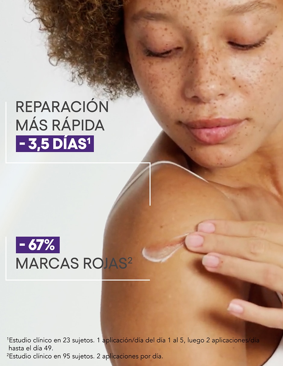Crema para cuerpo recomendada para reparar de día y noche Epitheliale Ultra Repair para piel sensible 4