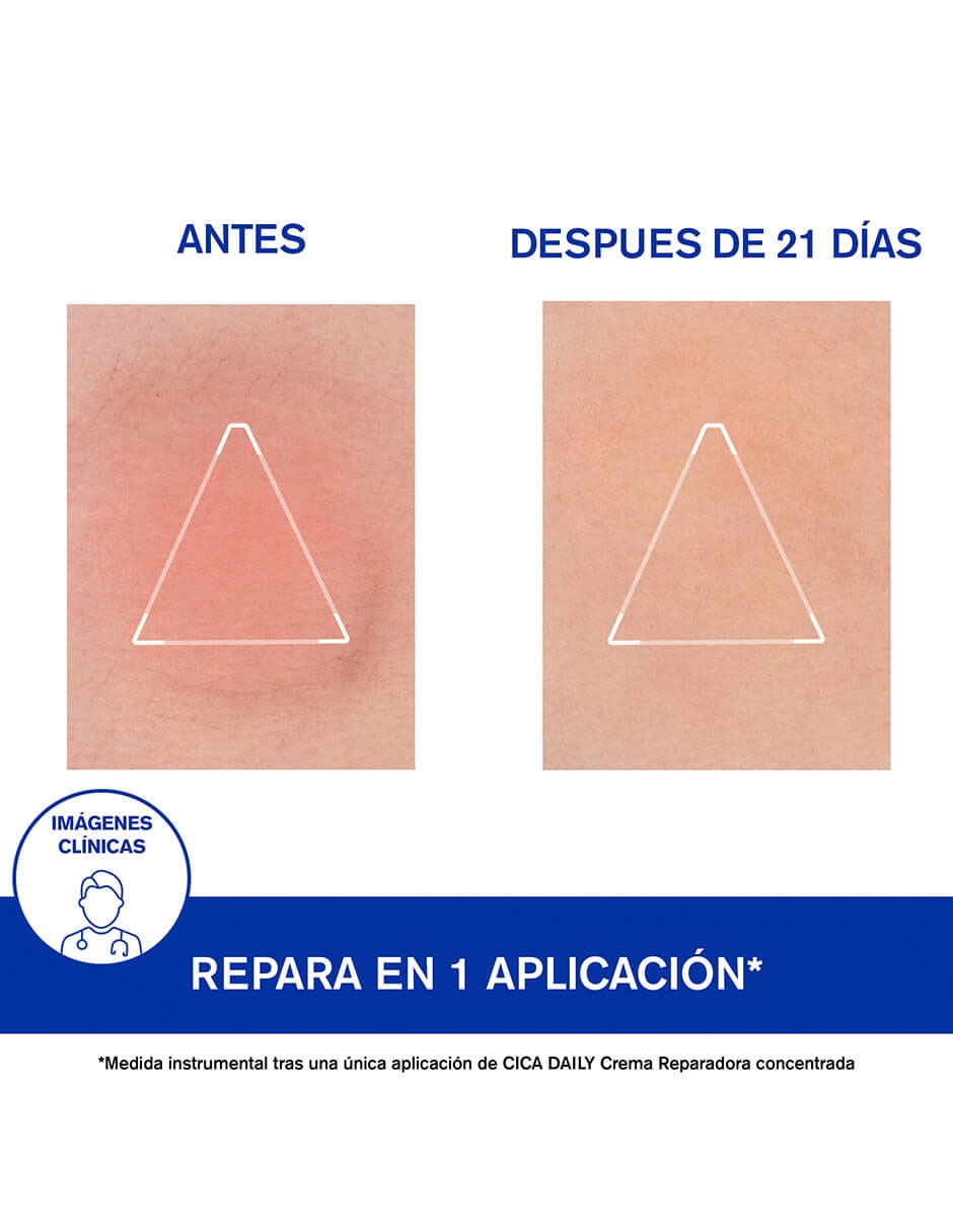 Crema facial recomendada para reparar día y noche Cica Daily para todo tipo piel 10
