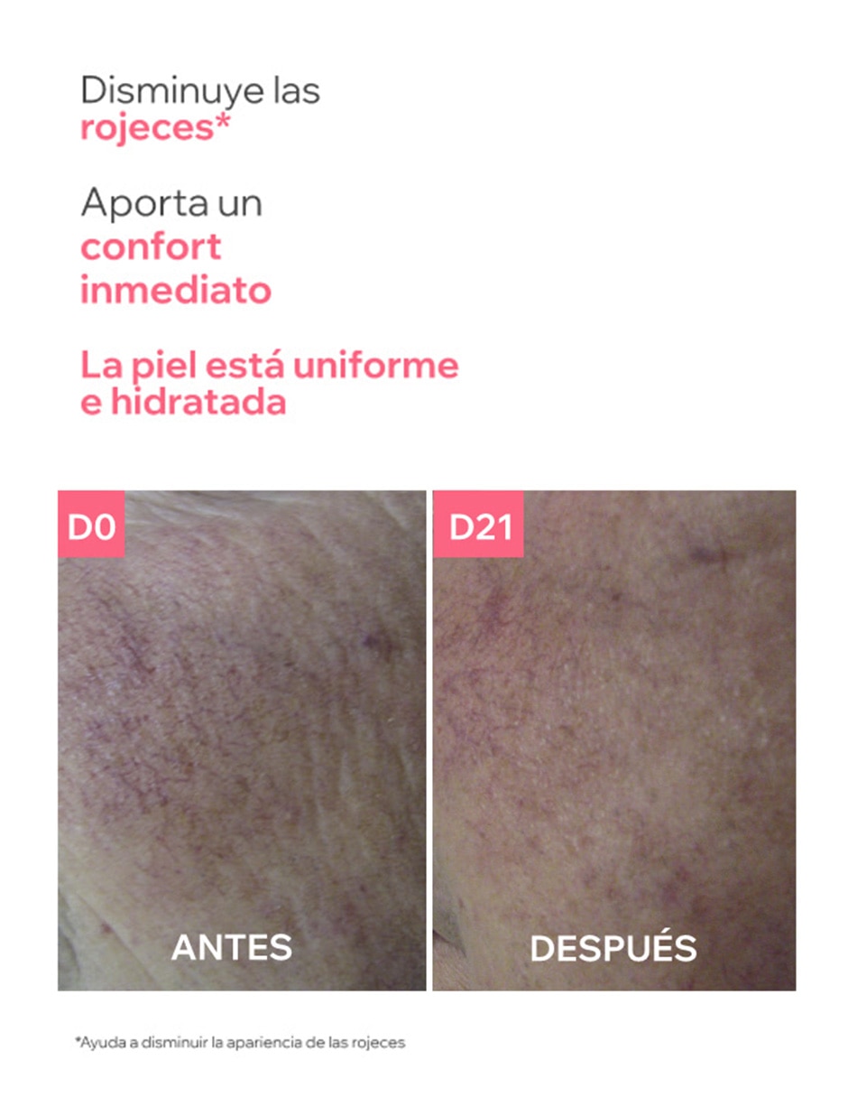 Crema facial recomendada para calmar y regenerar la piel día y noche para piel sensible 7