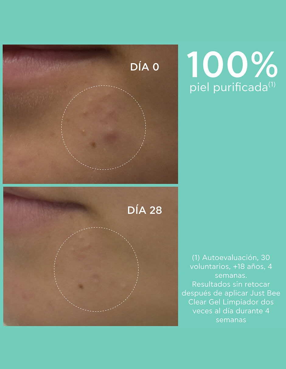 Limpiador facial Just Bee Clear Acne Line para acné 8