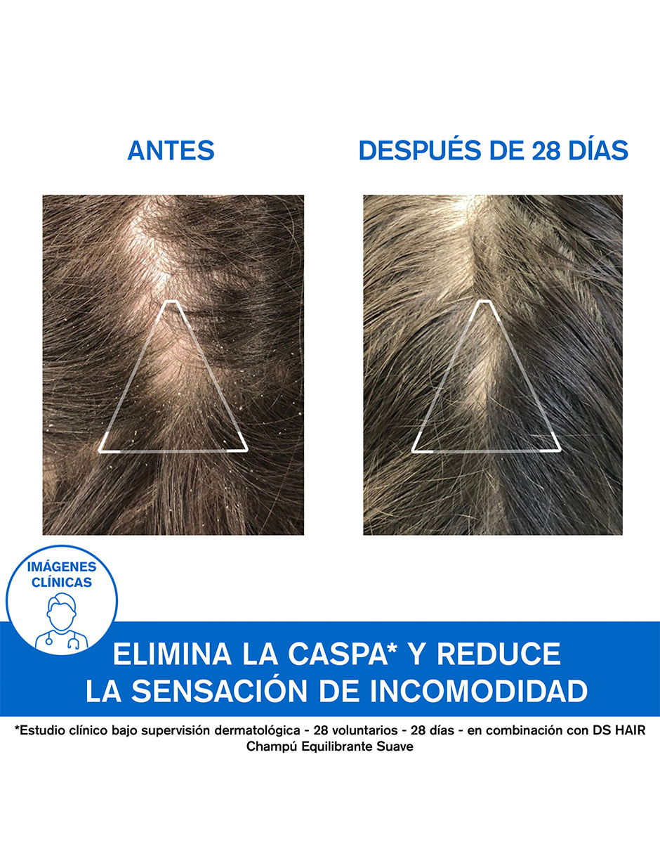 Shampoo anticaspa para cabello normal DS Hair D.S. 200 ml 8