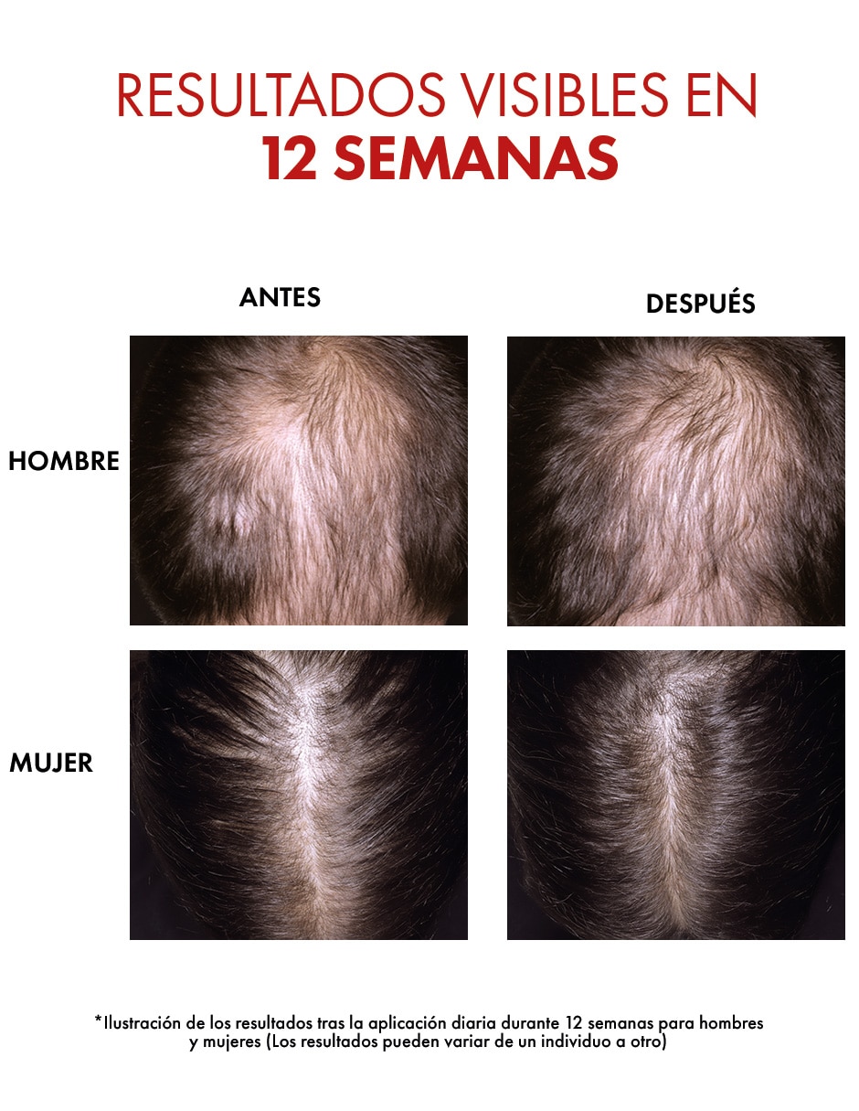 Sérum capilar Dercos regen 10