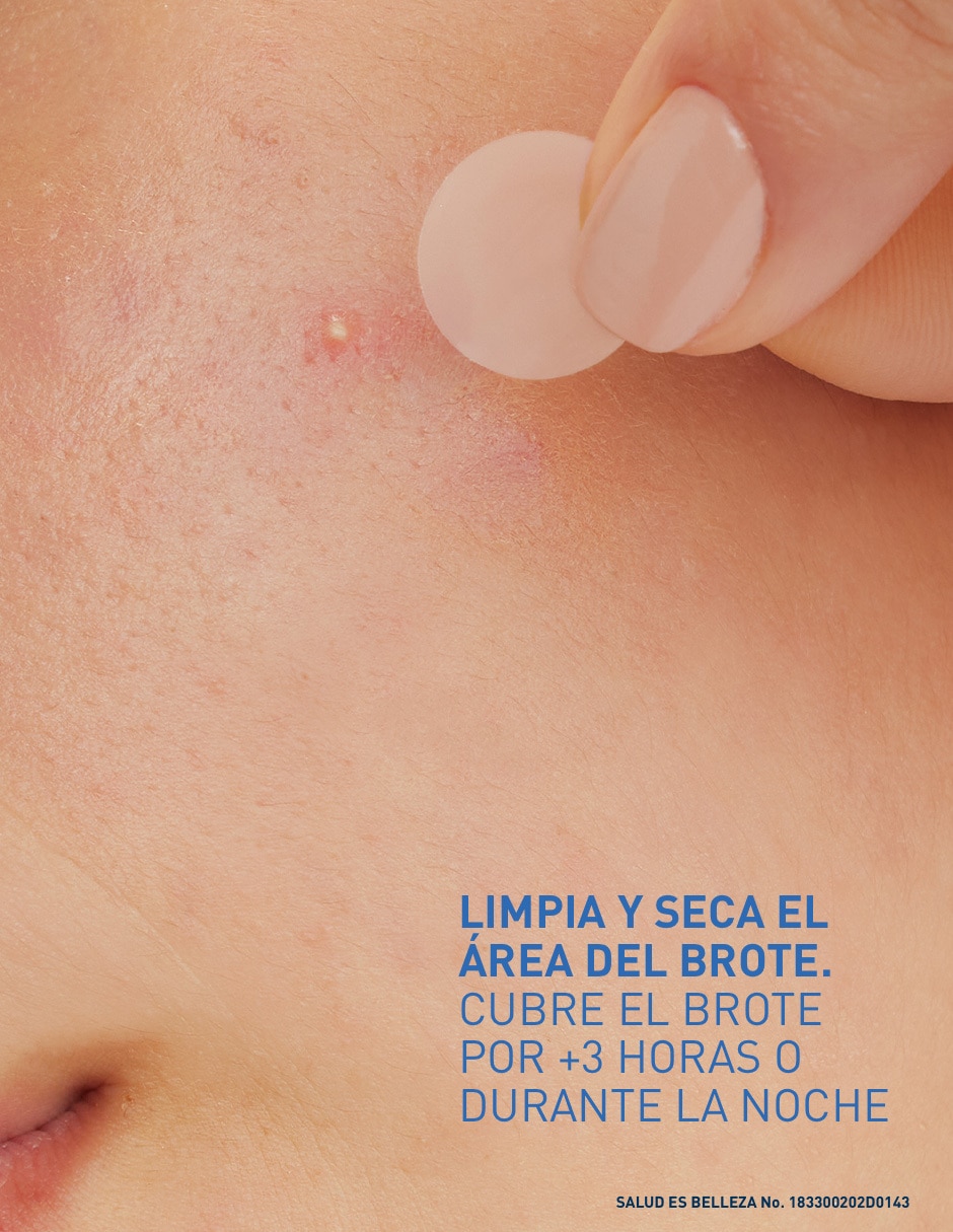 Parches para acné control imperfecciones 3