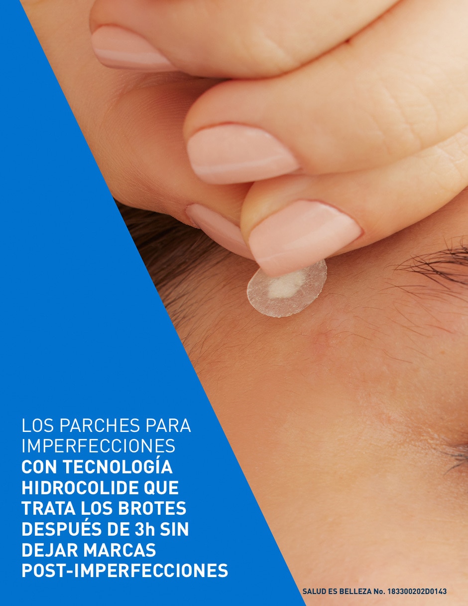Parches para acné control imperfecciones 5