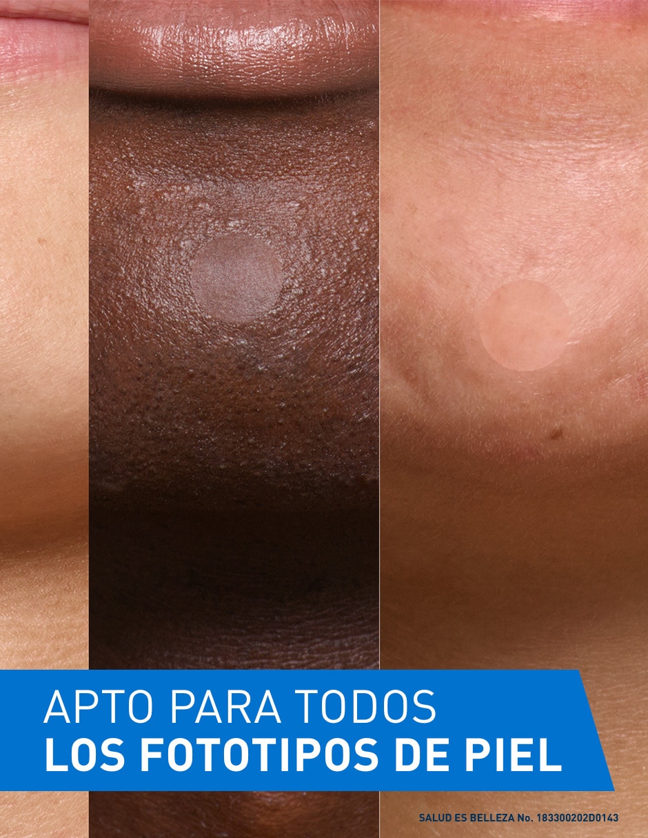 Parches para acné control imperfecciones 8