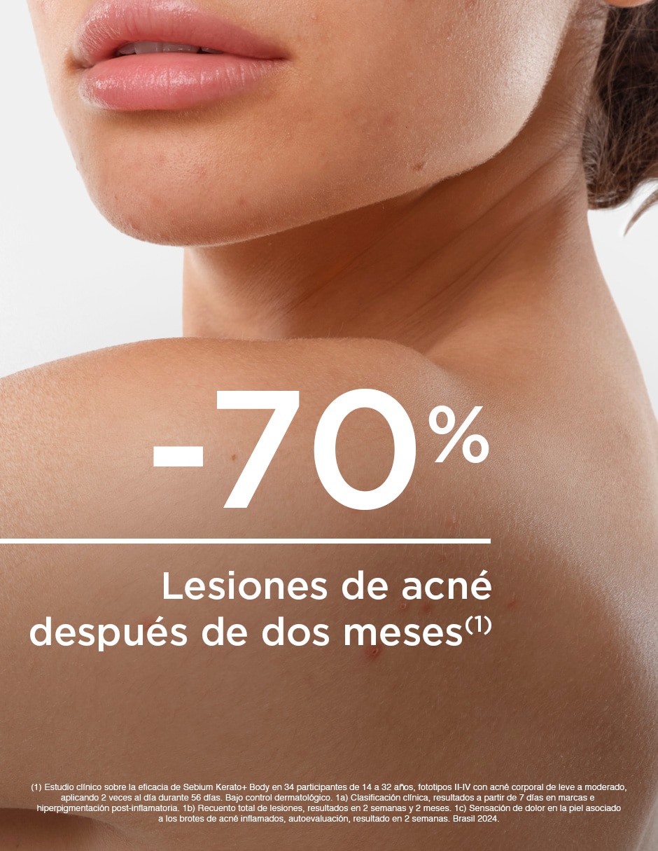 Tratamiento corporal Kerato+ Spray Antiacné Sébium 3