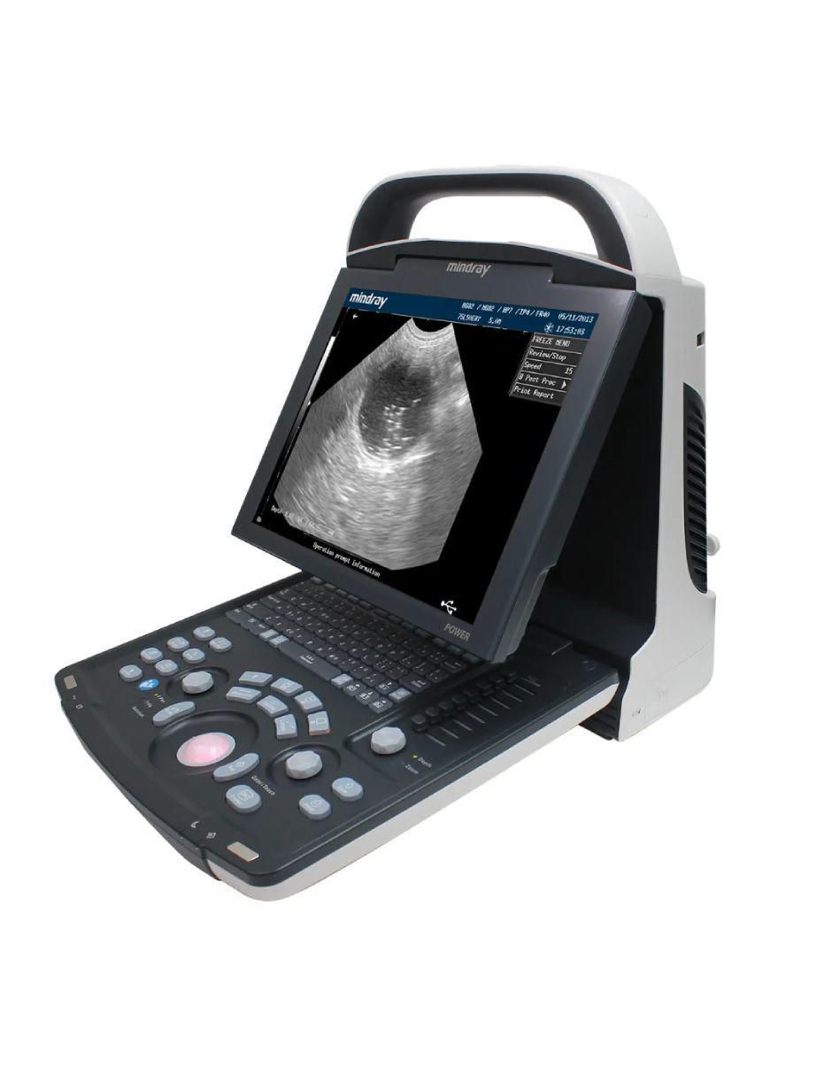 Máquina para ultrasonido facial y corporal con 1 cabezal 4