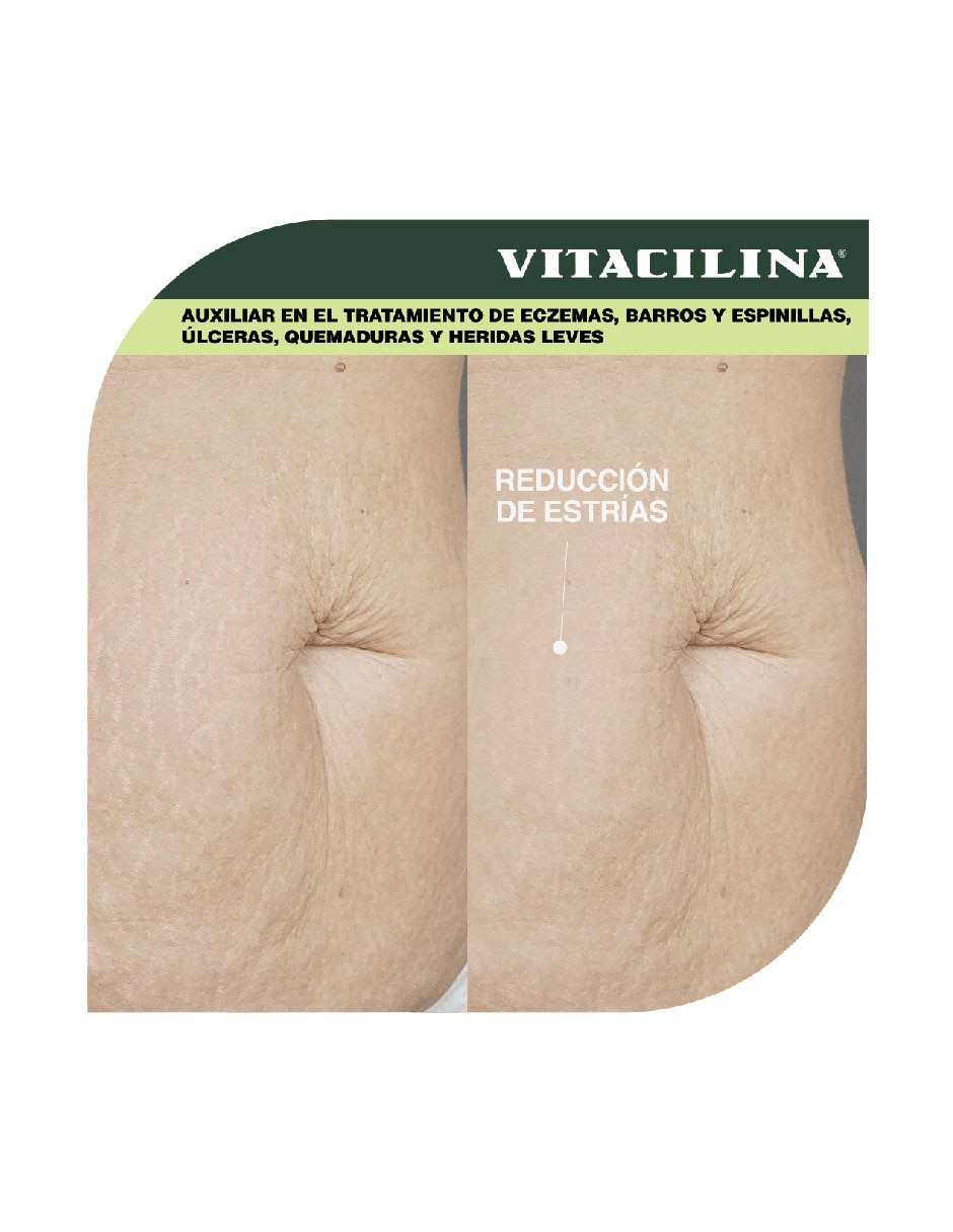 Ungüento 5